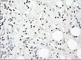 NRBP1 / NRBP Antibody (clone OTI5C3)