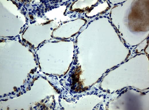 Monoclonal Mouse anti-Human KRT19 / CK19 / Cytokeratin 19 Antibody (clone UMAB3, aa240-390, IHC, IF, WB)