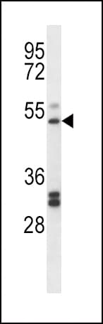 PTGIR / IP Receptor Antibody (aa210-238)