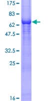 Human ARR3 / Cone Arrestin Protein (Recombinant GST)
