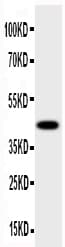 Polyclonal Rabbit anti-Human HSD17B2 Antibody (aa373-387, IHC, WB)