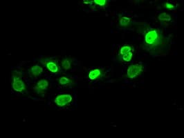 SATB1 Antibody (clone OTI13D6)