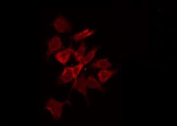 DOK6 Antibody