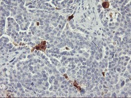 SDS Antibody (clone OTI2C11)