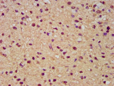 SLC19A2 / TC1 Antibody