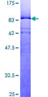 Human YY1 Protein (Recombinant GST)