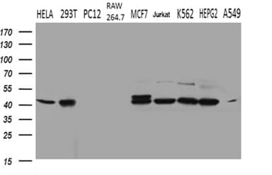 Monoclonal Mouse anti-Human STX18 / Syntaxin 18 Antibody (clone OTI3D7, aa1-285, IHC, WB)