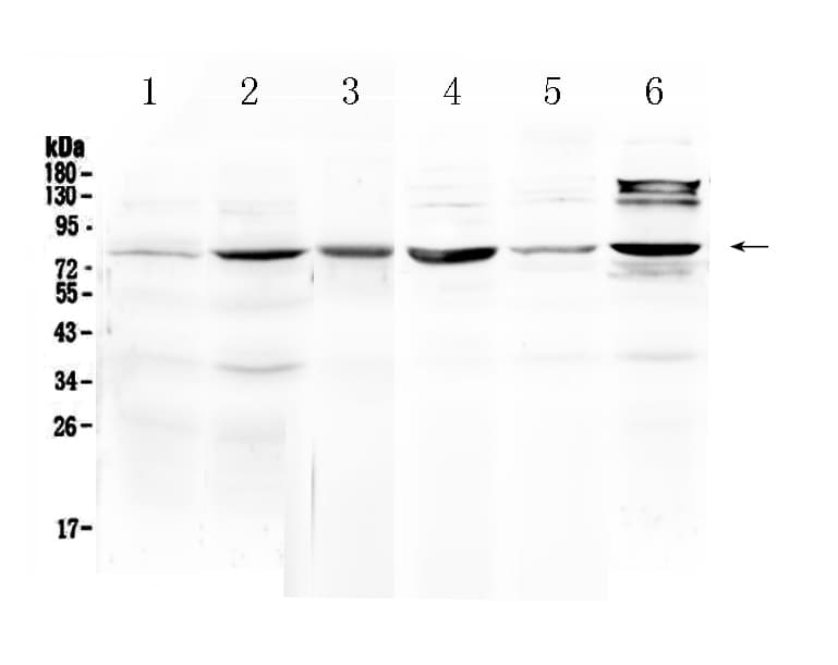 Polyclonal Rabbit anti-Human HSD17B4 Antibody (IHC, WB)