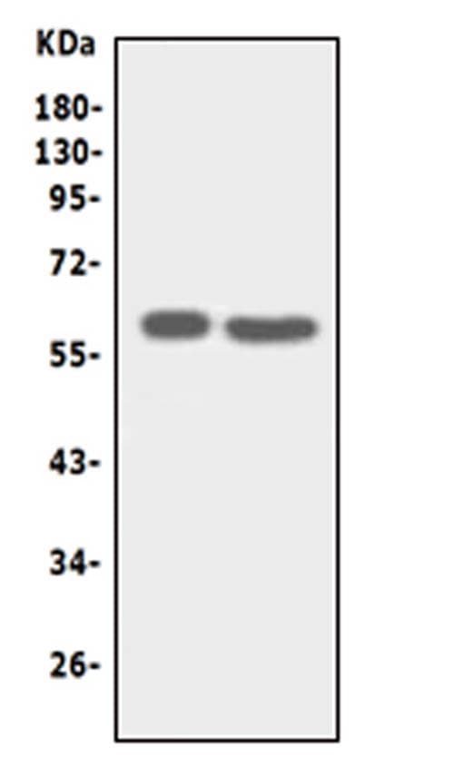 SLC22A6 / OAT1 Antibody (aa534-550)