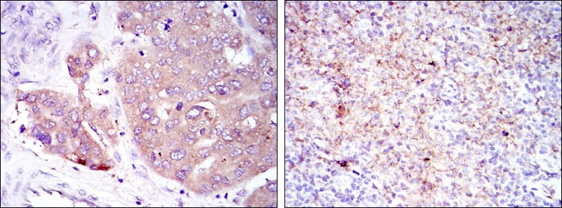 EIF4E Antibody (clone 5D11)