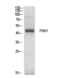 PSG1 / CD66f Antibody