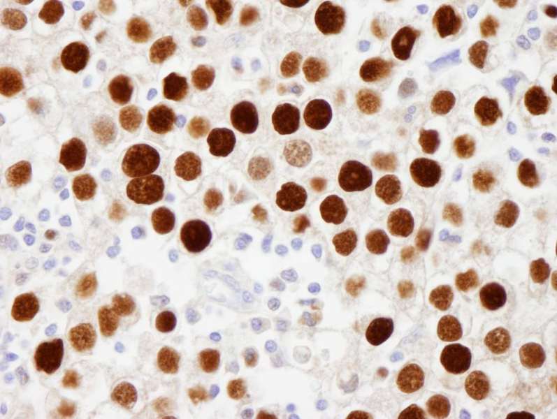 MCM2 Antibody (phospho-Ser108)
