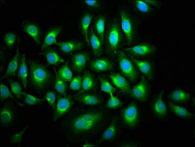 Polyclonal Rabbit anti-Human MAP3K9 / MLK1 Antibody (IHC, WB)