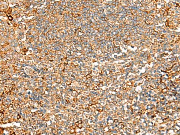 ASMTL Antibody