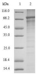 Mouse SRPX2 Protein (Recombinant 10His-SUMO, N-terminus + Myc, C-terminus)