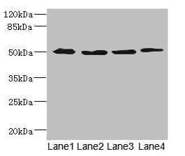 Polyclonal Rabbit anti-Human SQRDL Antibody (IHC, WB)