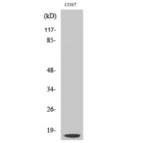 CTSD / Cathepsin D Antibody (20-100 aa, Internal)