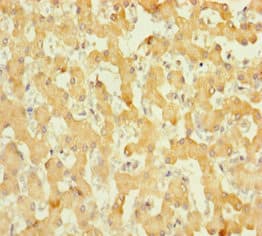 Polyclonal Rabbit anti-Human ABHD14B Antibody (aa2-210)