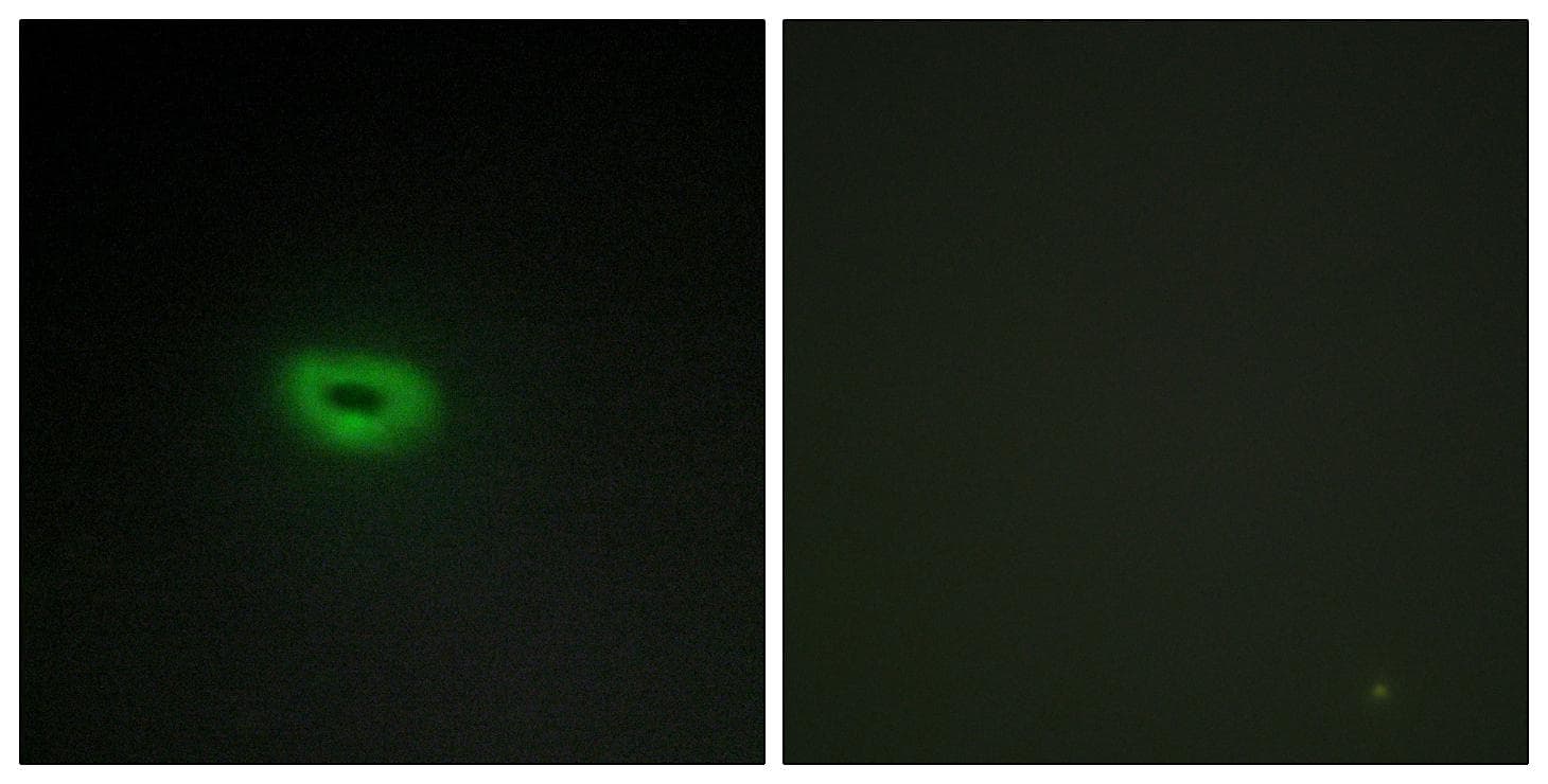 Polyclonal Rabbit anti-Human C2orf40 / ECRG4 Antibody (IHC, IF)