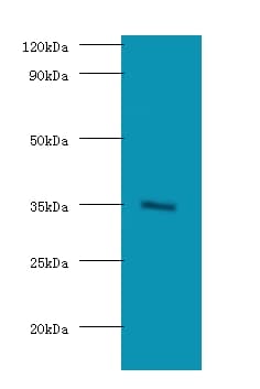 BRCC3 / BRCC36 Antibody (HRP)