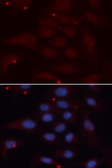 KPNA1 / Importin Alpha 5 Antibody