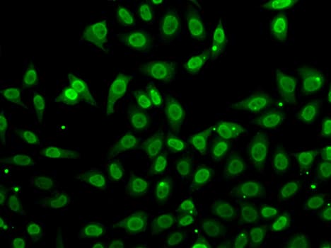 GCL / Grancalcin Antibody