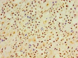 DGKE / DGK Epsilon Antibody (aa40-260)