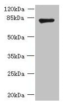 FBXO30 Antibody