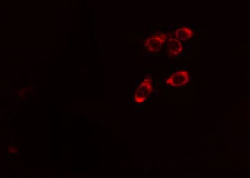 c-CBL Antibody (phospho-Tyr674)