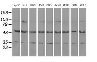 LEMD3 / MAN1 Antibody (clone OTI3C8, Carrier-free)