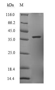 Zaire Ebolavirus Minor NucleoProtein VP30 (Recombinant 6His, N-terminus)