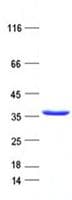 Human SLA Protein (Recombinant His, N-Terminal)