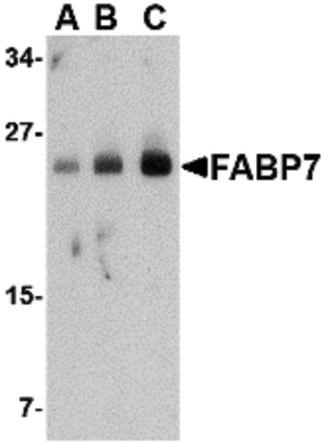 FABP7 / BLBP / MRG Antibody