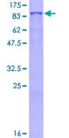 Human GFPT2 Protein (Recombinant GST)