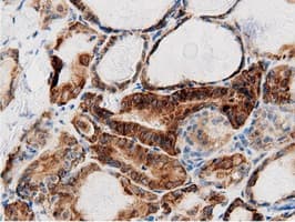 AK5 / Adenylate Kinase 5 Antibody (clone OTI2F9)