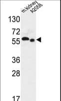Polyclonal Rabbit anti-Human SLC47A2 Antibody (aa125-153, WB)