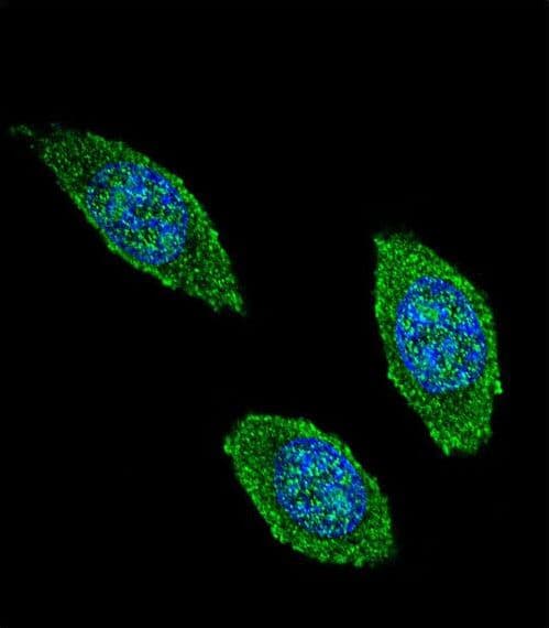 CSF2 / GM-CSF Antibody (aa59-85)