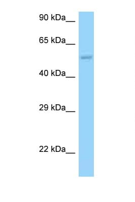HARS2 Antibody (N-Terminus)