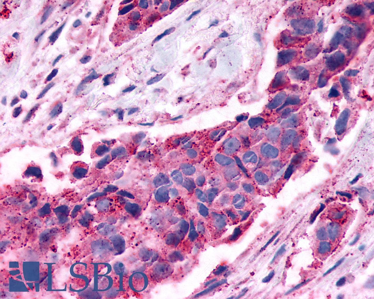 PathPlus™ NPY4R / PPYR1 Antibody (Extracellular Domain)