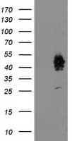 ASCC1 Antibody (clone OTI2D7)