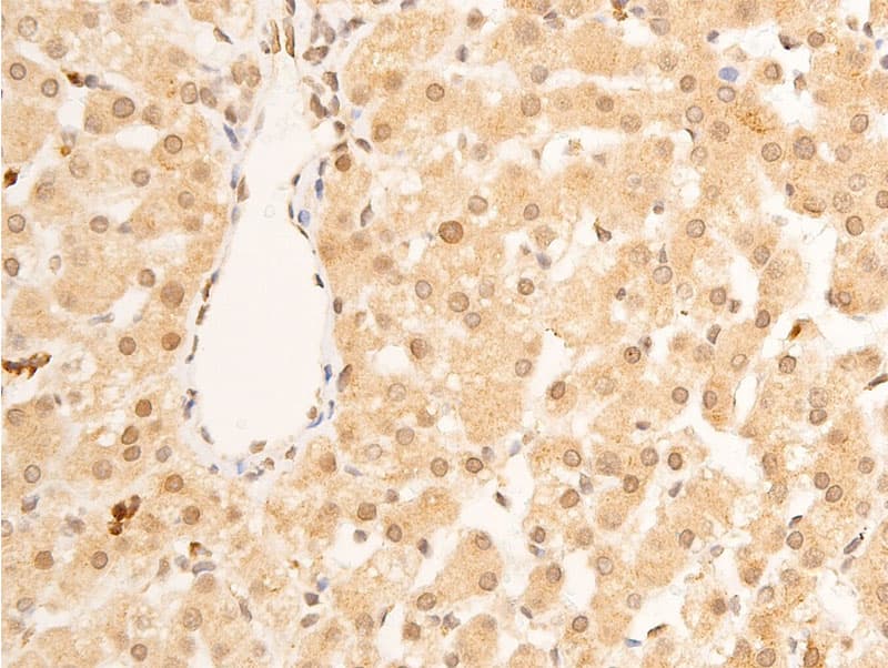 LMNA / Lamin A+C Antibody (phospho-Ser392)