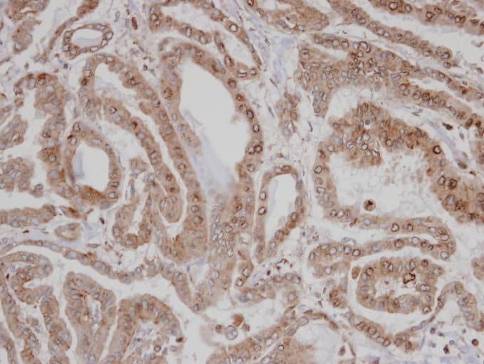 CAMK1D Antibody (aa1-205)