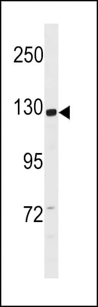 CCDC14 Antibody (aa377-406)