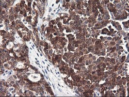 FBXO21 Antibody (clone OTI3C11, Carrier-free)