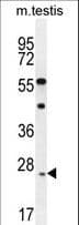 IHC-plus™ ROPN1L Antibody (aa32-60)
