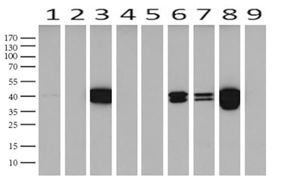 KRT19 / CK19 / Cytokeratin 19 Antibody (aa240-390, clone UMAB187, Carrier-free)