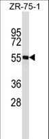 Polyclonal Rabbit anti-Human SPN / CD43 Antibody (aa35-64, WB)
