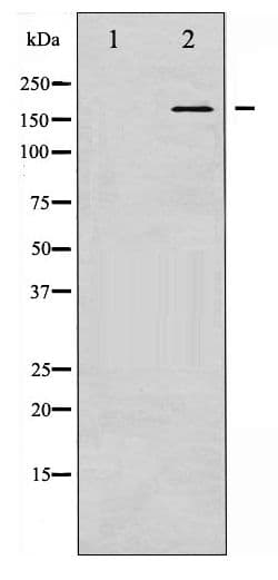 GRIN2B / NMDAR2B / NR2B Antibody (phospho-Tyr1474)
