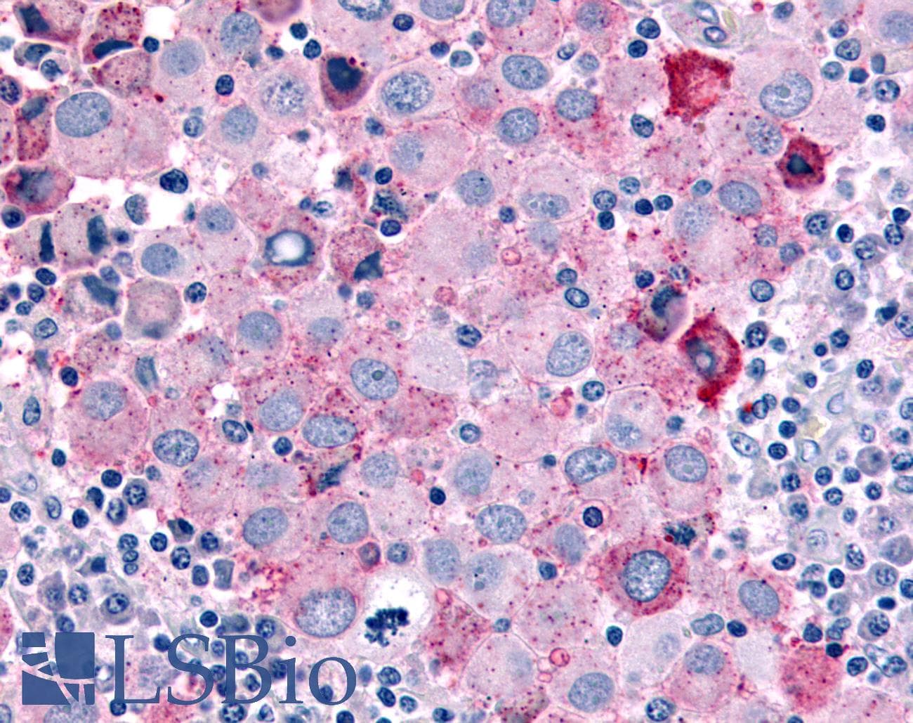 PathPlus™ CDC7 Antibody (Kinase Domain)