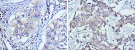 Monoclonal Mouse anti-Human RTN3 / Reticulon 3 Antibody (clone 10A8, IHC)